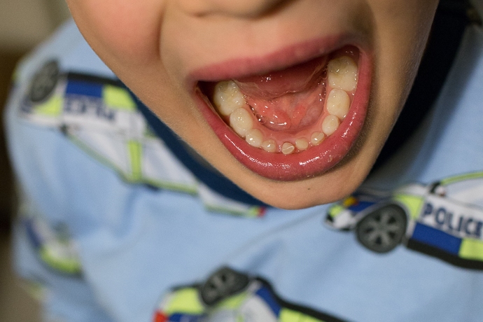 zahngeschichten-0172